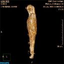 Fig. 2 - Scan of mummy LB 1355 - Courtesy of the NINO