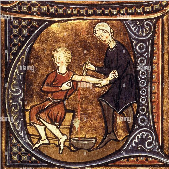 Figure 3. Bloodletting was seen as a way to restore the balance between the four bodily humors. This practice was commonly used to treat migraines from the ancient Greeks up until the 19th century.  [Science History Images](https://www.alamy.com/stock-photo-medieval-bloodletting-135097299.html) 