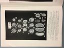 Fig. 1: Various Brushite-Whitlockite Bezoars in van Tassel, Bezoars and the Collection of Henri van Heurck, 1970, Antwerp, pl. I. Cross-sections of genuine bezoars demonstrating the characteristic onion ring pattern within. 