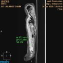 Fig. 3 - Scan van mummie LB 13555 - Met dank aan het NINO