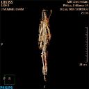 Fig. 1 - Scan of mummy LB 1355 - Courtesy of the NINO