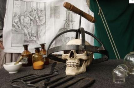 Figure 2. This trepanation gimlet was used during the Middle Ages to hold the patient’s head still while a hole was drilled into the skull.  Photo by Markus Matzel, [Getty images](https://www.gettyimages.nl/detail/nieuwsfoto%27s/deutschland-nrw-dortmund-the-spectaculum-from-medieval-nieuwsfotos/549405201?adppopup=true) 